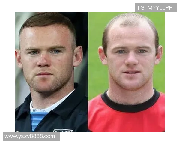 全球著名没头发的足球明星盘点及其背后故事